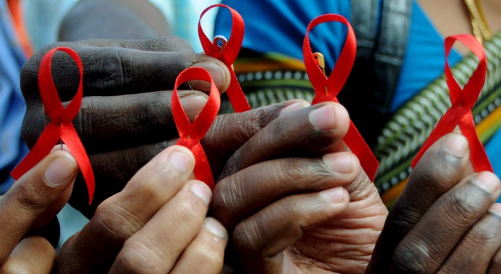 ВИЧ-инфекция и СПИД