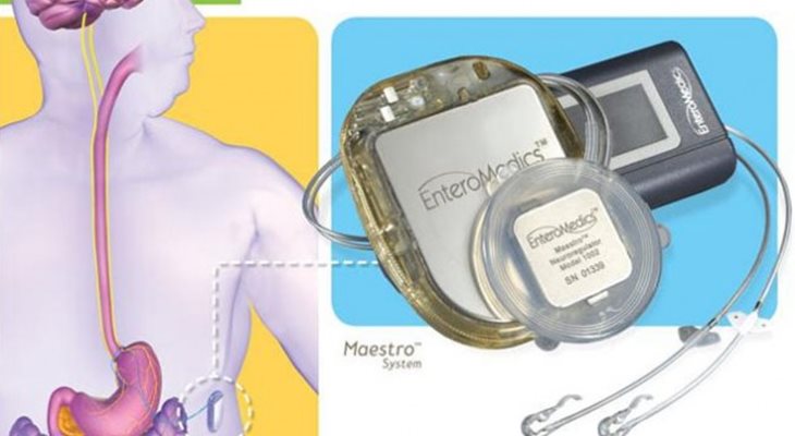 Инновационная система «Маэстро» для похудения одобрена для использования