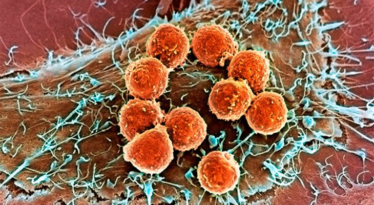 T-лимфоциты атакуют раковые клетки